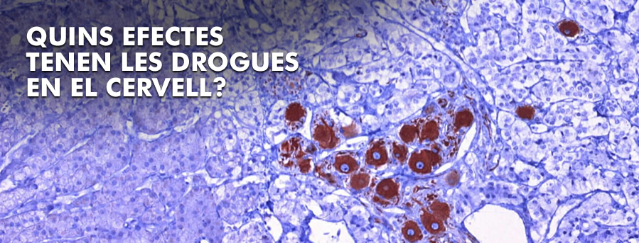 Quins efectes tenen les drogues en el cervell?