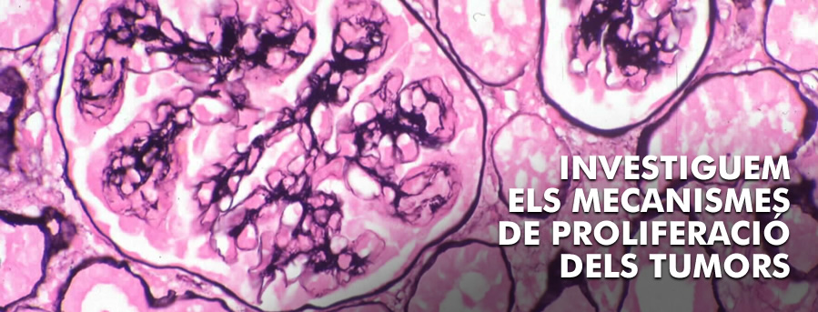 Investiguem els mecanisme de proliferació de tumors