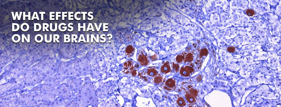 What effects do drugs have on our brains?