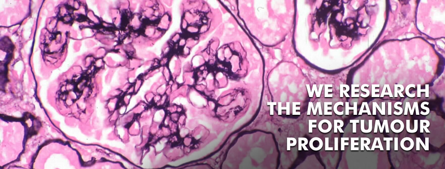 We research the mechanisns for tumour proliferation