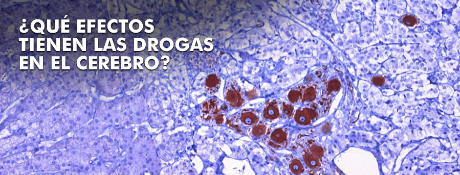 ¿Qué efectos tienen las drogas en el cerebro?