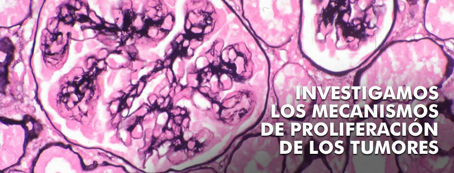 Investigamos los mecanismos de proliferación de los tumores